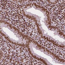 CTCF Antibody (CL0307), Novus Biologicals 25 &mu;L, Unconjugated:Antibodies,