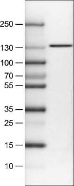 CTCF Antibody (CL0307), Novus Biologicals 25 &mu;L, Unconjugated:Antibodies,