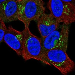 PRR36 Antibody, Novus Biologicals 25 &mu;L, Unconjugated:Antibodies, Polyclonal