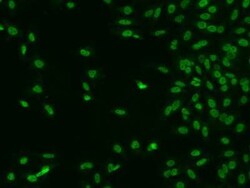 CTDSP2 Antibody, Novus Biologicals 100 &mu;g | Buy Online | Novus Biologicals | Fisher Scientific