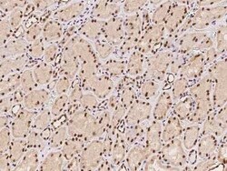 CTDSP2 Antibody, Novus Biologicals 100 &mu;g | Buy Online | Novus Biologicals | Fisher Scientific