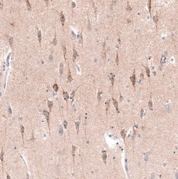 CTGF/CCN2 Antibody (CL5339), Novus Biologicals 100&mu;L:Antibodies, Monoclonal