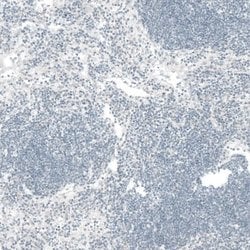 CTGF/CCN2 Antibody (CL5339), Novus Biologicals 100&mu;L:Antibodies, Monoclonal