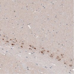 CTGF/CCN2 Antibody (CL5339), Novus Biologicals 100&mu;L:Antibodies, Monoclonal