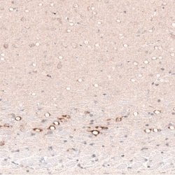 CTGF/CCN2 Antibody (CL5339), Novus Biologicals 100&mu;L:Antibodies, Monoclonal