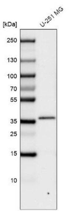 CTGF/CCN2 Antibody (CL5339), Novus Biologicals 100&mu;L:Antibodies, Monoclonal
