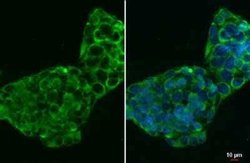CTGF/CCN2 Antibody (28711), Novus Biologicals 100 &mu;g; Unconjugated:Antibodies,