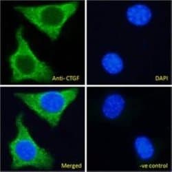 CTGF/CCN2 Antibody, Novus Biologicals 100&mu;g:Antibodies, Polyclonal
