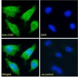 CTGF/CCN2 Antibody, Novus Biologicals 100 &mu;g Unconjugated:Antibodies,