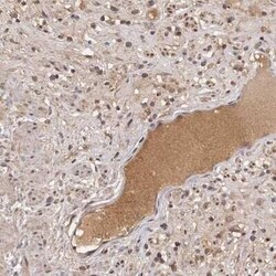 CTGF/CCN2 Antibody, Novus Biologicals 0.1 mL | Buy Online | Novus Biologicals | Fisher Scientific