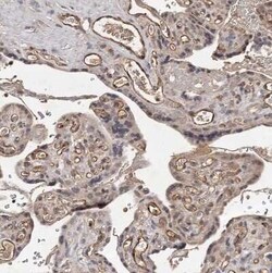 CTGF/CCN2 Antibody, Novus Biologicals 0.1 mL | Buy Online | Novus Biologicals | Fisher Scientific