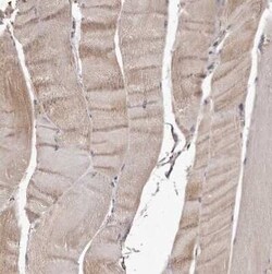 CTGF/CCN2 Antibody, Novus Biologicals 0.1 mL | Buy Online | Novus Biologicals | Fisher Scientific