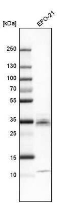 CTGF/CCN2 Antibody, Novus Biologicals 0.1 mL | Buy Online | Novus Biologicals | Fisher Scientific