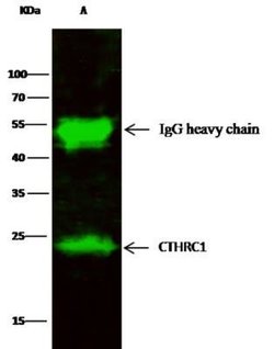 CTHRC1 Rabbit anti-Human, Clone: 166, Novus Biologicals 50 &mu;g | Buy Online | Novus Biologicals | Fisher Scientific