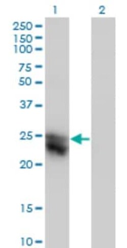 CTHRC1 Antibody (1G12), Novus Biologicals 0.1 mg | Buy Online | Novus Biologicals | Fisher Scientific