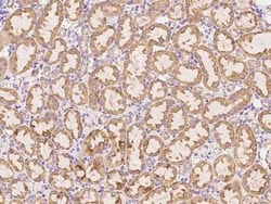 CTHRC1 Antibody, Novus Biologicals 100 &mu;g | Buy Online | Novus Biologicals | Fisher Scientific