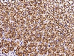 CTHRC1 Antibody, Novus Biologicals 100 &mu;g | Buy Online | Novus Biologicals | Fisher Scientific