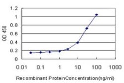 CTL1/SLC44A1 Antibody (1C4), Novus Biologicals 0.1 mg | Buy Online | Novus Biologicals | Fisher Scientific