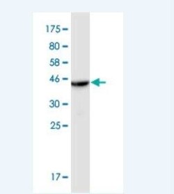 CTL1/SLC44A1 Antibody (4E12), Novus Biologicals 0.1 mg | Buy Online | Novus Biologicals | Fisher Scientific