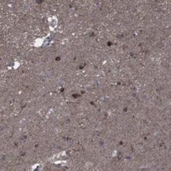 CTL1/SLC44A1 Rabbit anti-Human, Polyclonal, Novus Biologicals 100 &mu;g;