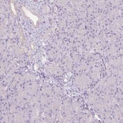 CTNNA3 Antibody, Novus Biologicals:Antibodies:Primary Antibodies