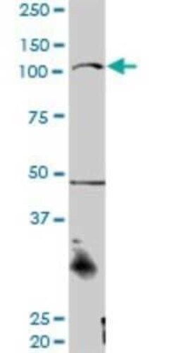 CTNNA3 Antibody, Novus Biologicals 0.1 mg | Buy Online | Novus Biologicals | Fisher Scientific