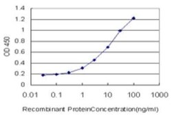 CTNNAL1 Antibody (1H5), Novus Biologicals 0.1 mg, Unconjugated:Antibodies,