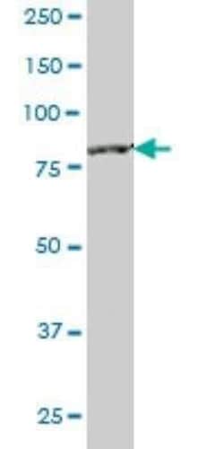 CTNNAL1 Antibody (2C11), Novus Biologicals 0.1 mg; Unconjugated:Antibodies,