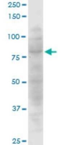 CTNNAL1 Antibody (3C8), Novus Biologicals 0.1 mg | Buy Online | Novus Biologicals | Fisher Scientific