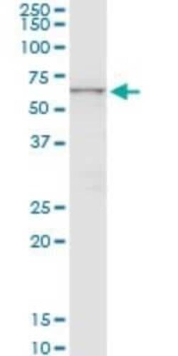 CTNS Antibody (5G6), Novus Biologicals 0.1 mg | Buy Online | Novus Biologicals | Fisher Scientific