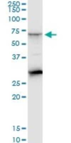 CTNS Antibody (5G6), Novus Biologicals 0.1 mg | Buy Online | Novus Biologicals | Fisher Scientific