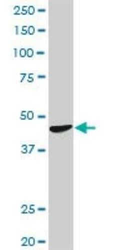 CTNS Antibody, Novus Biologicals 0.1 mg | Buy Online | Novus Biologicals | Fisher Scientific