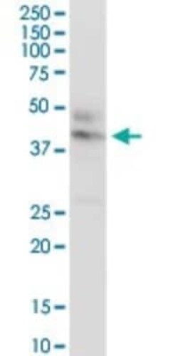 CTNS Antibody, Novus Biologicals 0.1 mg | Buy Online | Novus Biologicals | Fisher Scientific