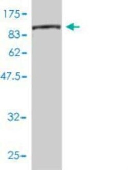 CTP synthase Antibody (2G7-1D10), Novus Biologicals 0.1 mg | Buy Online | Novus Biologicals | Fisher Scientific