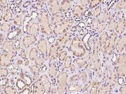CTR2 Antibody, Novus Biologicals 50 &mu;g, Unconjugated:Antibodies, Polyclonal