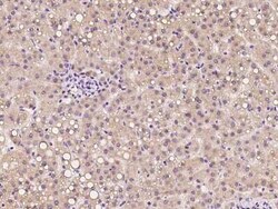 CTR2 Antibody, Novus Biologicals 50 &mu;g, Unconjugated:Antibodies, Polyclonal