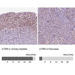 CTR9 Antibody, Novus Biologicals:Antibodies:Primary Antibodies