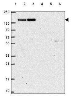 CTR9 Antibody, Novus Biologicals:Antibodies:Primary Antibodies