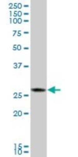 CTRB1 Antibody, Novus Biologicals 0.05 mg | Buy Online | Novus Biologicals | Fisher Scientific