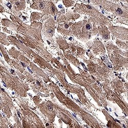 Human CTRP1/C1qTNF1 Antibody, R D Systems:Antibodies:Primary Antibodies