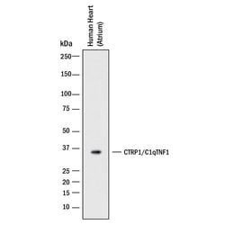 Human CTRP1/C1qTNF1 Antibody, R D Systems:Antibodies:Primary Antibodies