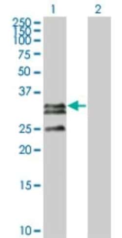 CTRP2 Antibody (1D7-2C7), Novus Biologicals 0.1 mg; Unconjugated:Antibodies,