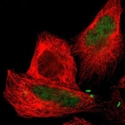 CTRP6 Antibody, Novus Biologicals 25 &mu;L | Buy Online | Novus Biologicals | Fisher Scientific