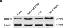 CTRP9/C1qTNF9 Antibody, Novus Biologicals 25 &mu;L, Unconjugated:Antibodies,