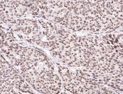 CUEDC2 Rabbit anti-Human, Clone: 3, Novus Biologicals:Antibodies:Primary