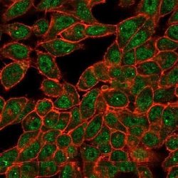 CUGBP2 Mouse anti-Human, Clone: PCRP-CELF2-1E4, Novus Biologicals:Antibodies:Primary