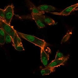 CUGBP2 Mouse anti-Human, Clone: PCRP-CELF2-1E4, Novus Biologicals:Antibodies:Primary
