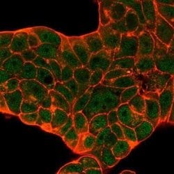 CUGBP2 Mouse anti-Human, Clone: PCRP-CELF2-1E4, Novus Biologicals:Antibodies:Primary