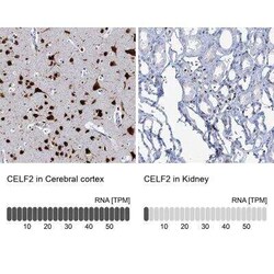 CUGBP2 Antibody, Novus Biologicals:Antibodies:Primary Antibodies