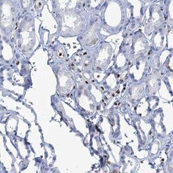 CUGBP2 Antibody, Novus Biologicals:Antibodies:Primary Antibodies